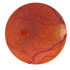 Salut ocular